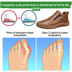 🐂【Ortesi plantare intelligente AI】Pelle di alta qualità + cucita a mano: un must per gli uomini🔴Podologo portatile