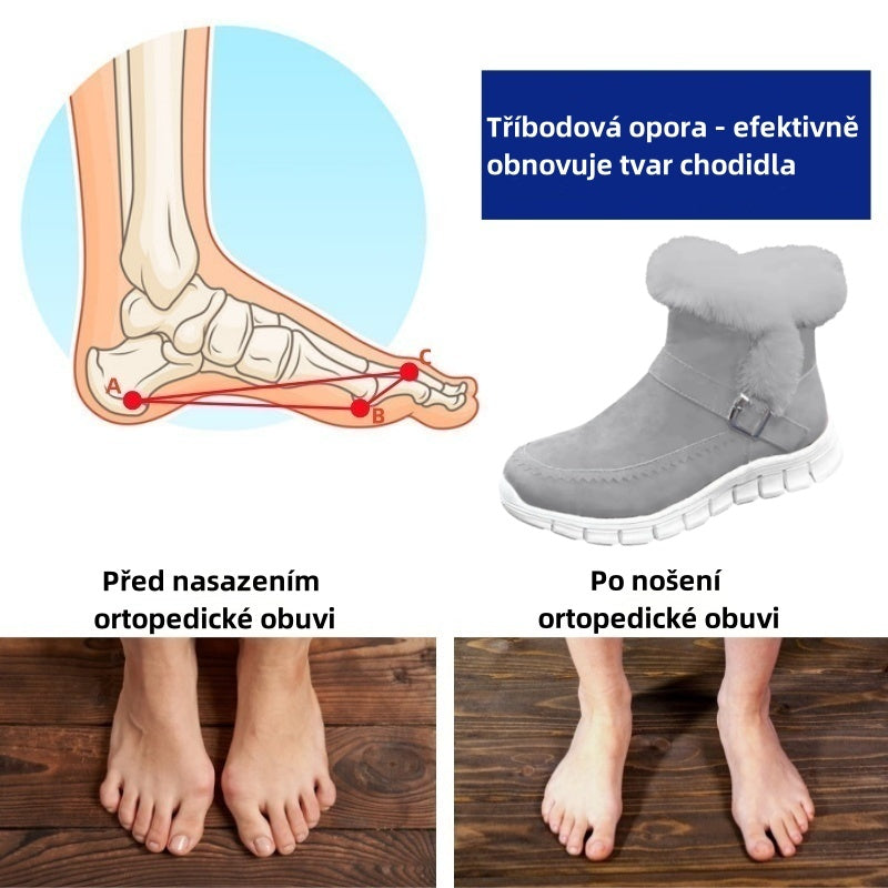 Plaxoo® | Offerta a tempo limitato: 50% di sconto! Stivali unisex sopra il ginocchio in peluche! Queste scarpe ortopediche sono dotate di supporto ergonomico dell'arco plantare e suola antiscivolo per una calzata unica.