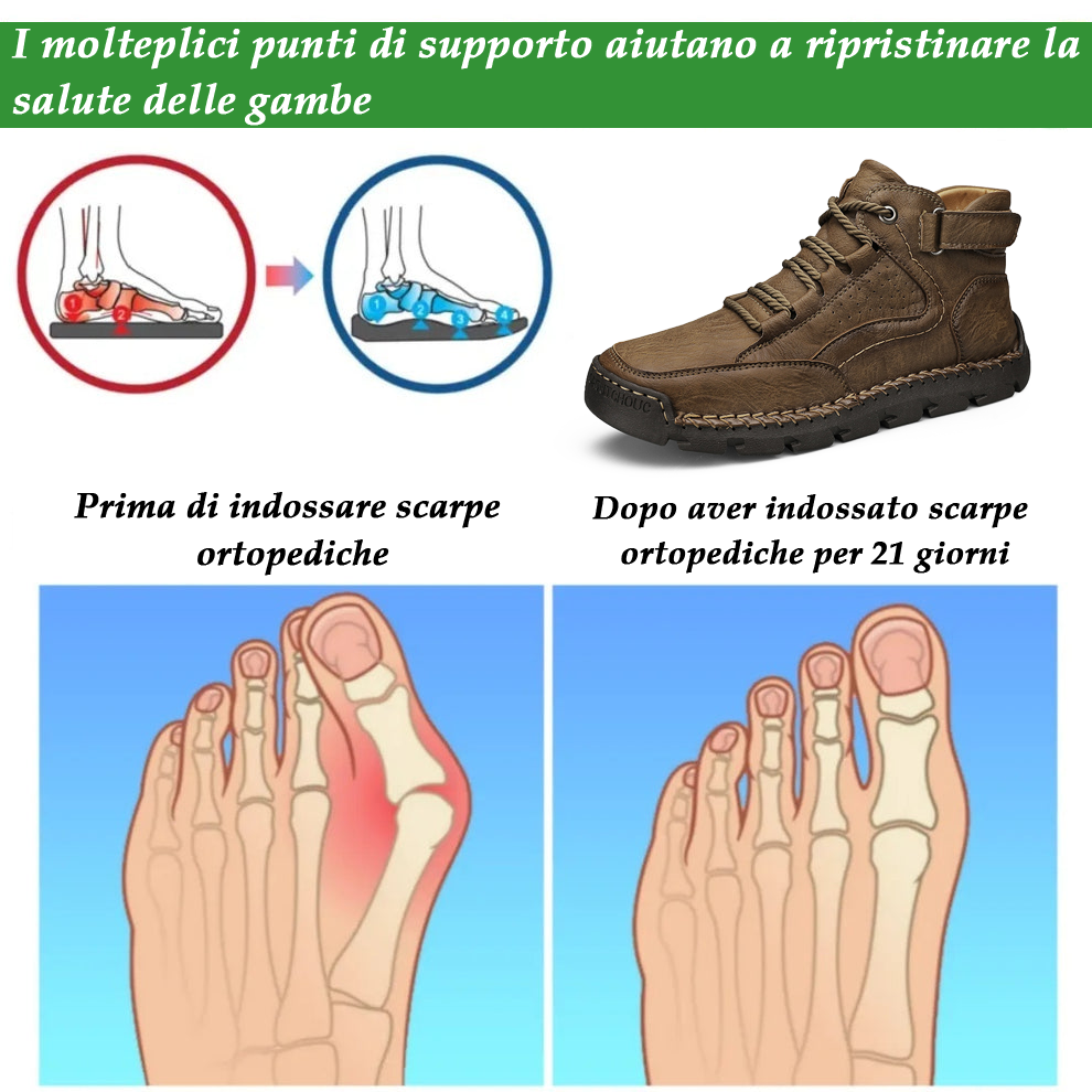 (🔥Sconto del 50% oggi - non lasciartelo sfuggire!) - 🐂 Scarpe comode ed eleganti in pelle di vitello italiana👞 (antiscivolo, supporto plantare, camminata facile)